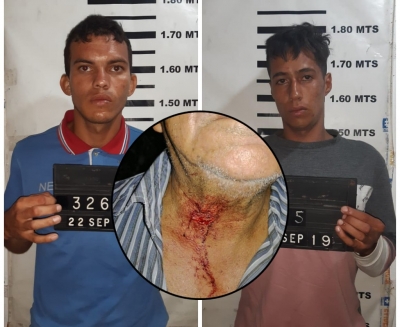En libertad atracadores venezolanos que hirieron a un taxista en el cuello en Yopal