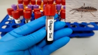 Nueva EPS identificó que 3 departamentos del país son más propensos a presentar casos de enfermedad de Chagas