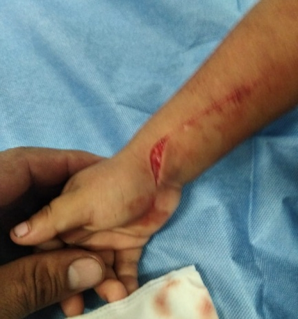 Investigar caso en donde resultó afectado su hijo en un CDI de Yopal pide padre de familia al ICBF