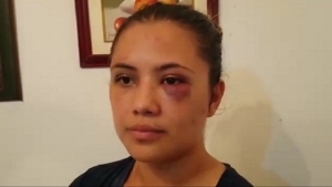 Una nueva víctima de violencia de género en Yopal