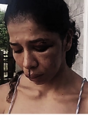 Agresor de mujer en Yopal, será desvinculado de Comfacasanare