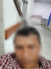 Violencia intrafamiliar en Orocué: Adolescente hiere a padrastro con cuchillo en la cabeza