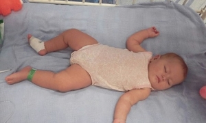 Urgente traslado a una UCI pediátrica requiere bebé de 9 meses con Dengue