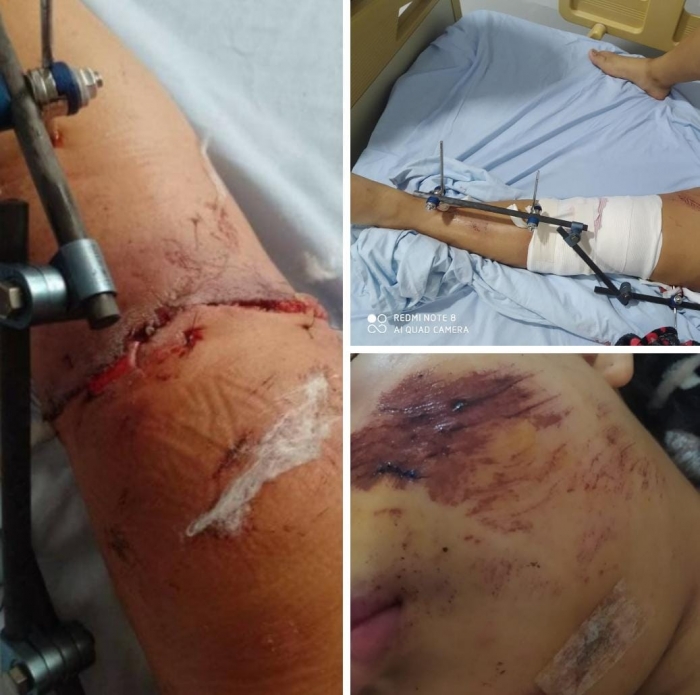 Familia busca a conductor quien en aparente estado de embriaguez ocasionó grave accidente que dejó tres mujeres con serias lesiones