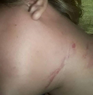 Un caso de violencia intrafamiliar fue denunciado ante la opinión pública