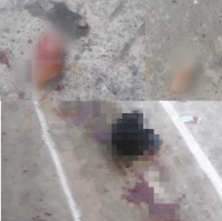 Con machete le cortaron dos dedos a un hombre en Yopal