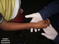 Bomberos atienden a menor con posible fractura en brazo en la vereda Iquía de Tauramena