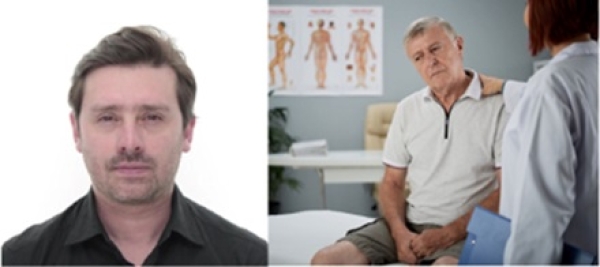 Cáncer de vejiga: Una enfermedad de bajo perfil, pero letal