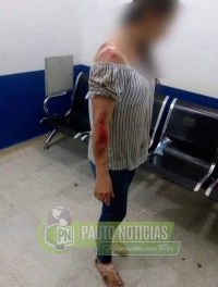 Ladrones arrastraron a docente para hurtarle el bolso en Paz de Ariporo