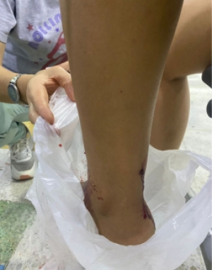 Pareja baleada y asaltada en la vía de San Rafael de Morichal – La Bendición