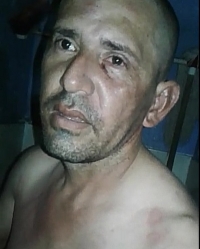 Golpeado en la cárcel, resultó señalado de feminicidio contra la menor del Meta