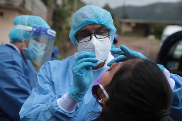 11000 pruebas moleculares para el diagnóstico de Covid19 se han tomado en Casanare