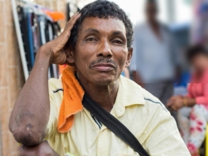 Por la vía de la indignación: Adulto mayor en condición de discapacidad fue atropellado por un motociclista