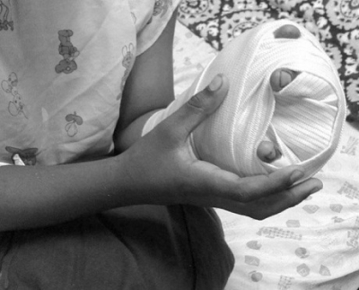 Tres niños de origen venezolano fueron víctimas de un incendio en Yopal