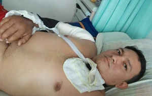 Víctima de accidente clama por una remisión