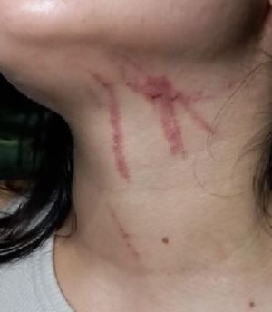 Joven de 24 años denunció que fue agredida por entrenador de fútbol de salón adscrito al Idry