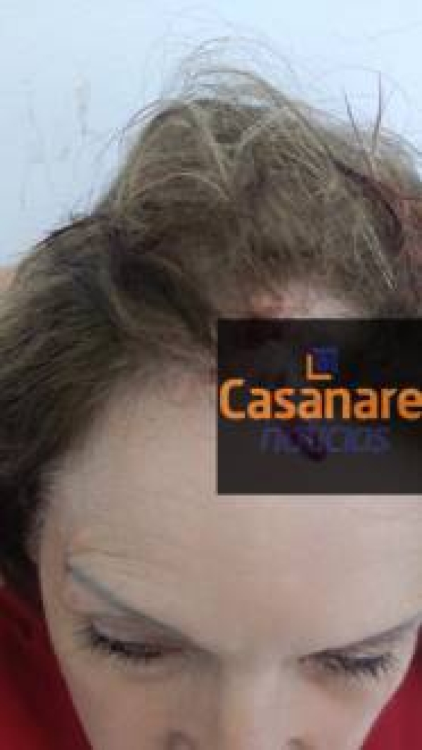 Presunto atracador capturado en Yopal queda en libertad por falta de "pruebas contundentes"