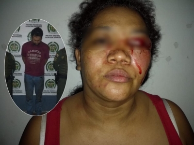 Una mujer fue agredida salvajemente por su pareja en Aguazul